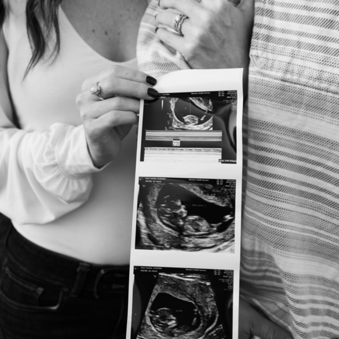 Photo shared by Caroline for their Babylist baby registry.