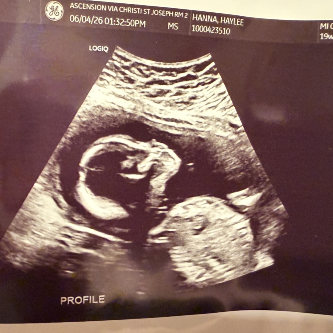 Photo shared by Haylee for their Babylist baby registry.