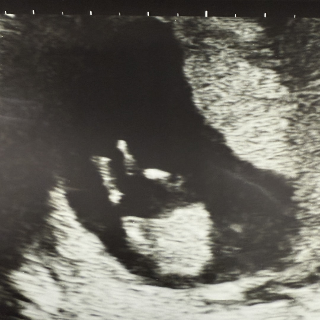 Photo shared by Julia for their Babylist baby registry.