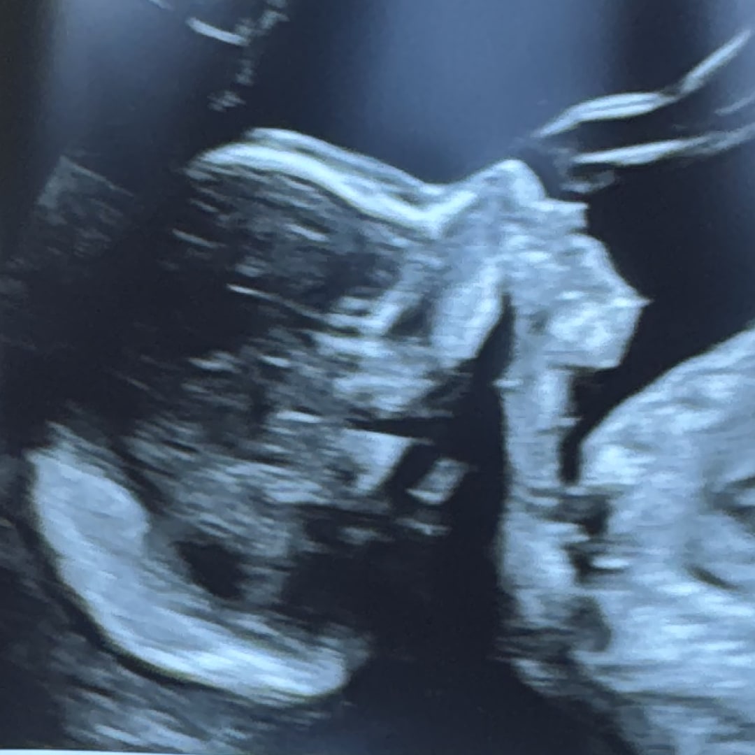 Photo shared by Maddy for their Babylist baby registry.