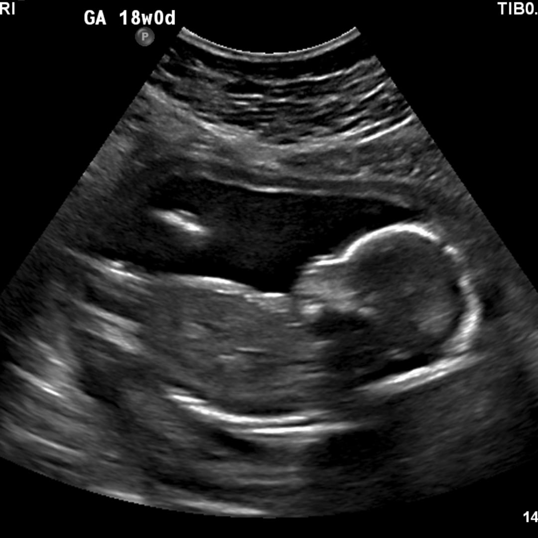 Photo shared by Abigail for their Babylist baby registry.