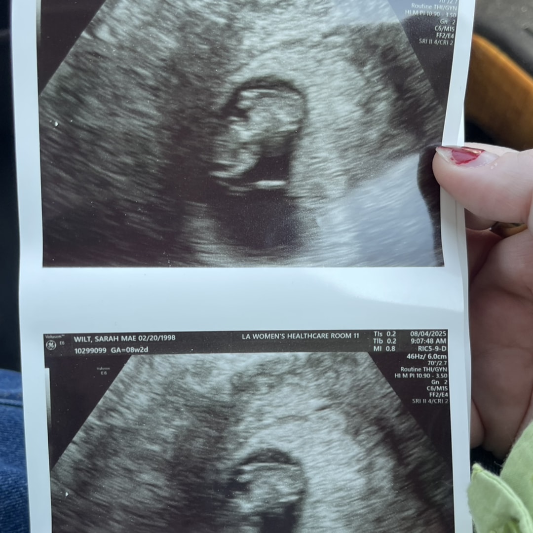 Photo shared by Sarah for their Babylist baby registry.