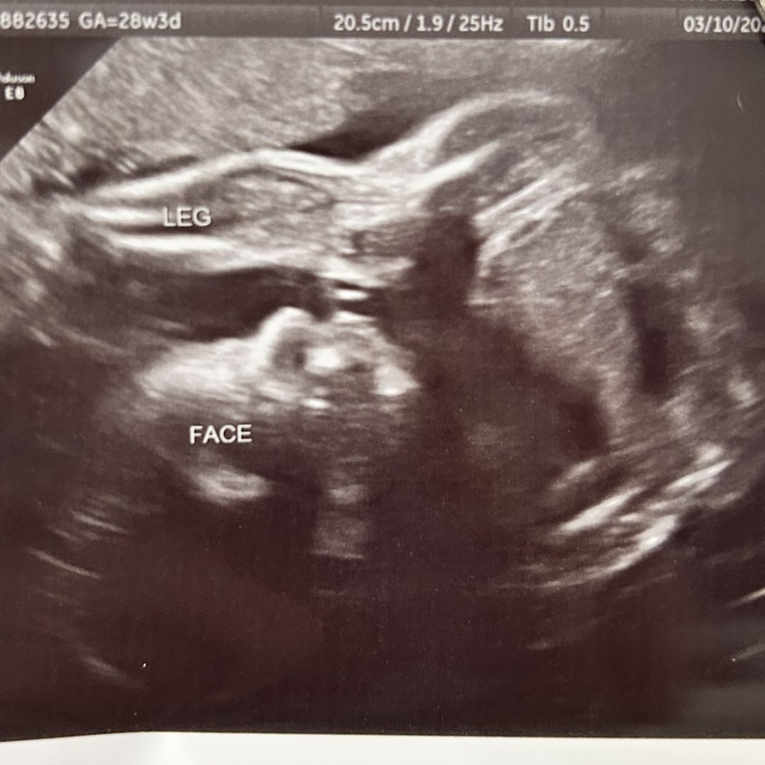 Photo shared by Clare for their Babylist baby registry.