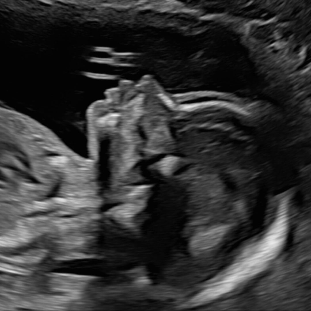 Photo shared by Emily for their Babylist baby registry.