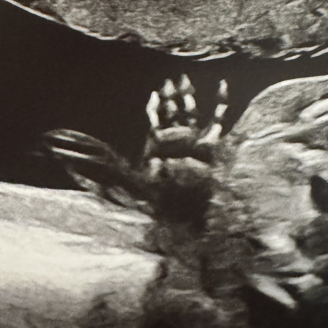 Photo shared by Kendra for their Babylist baby registry.