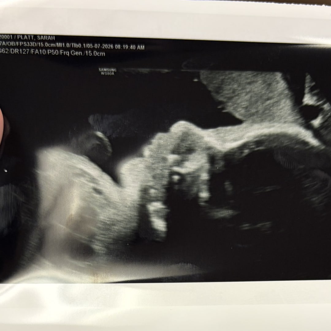 Photo shared by Sarah for their Babylist baby registry.