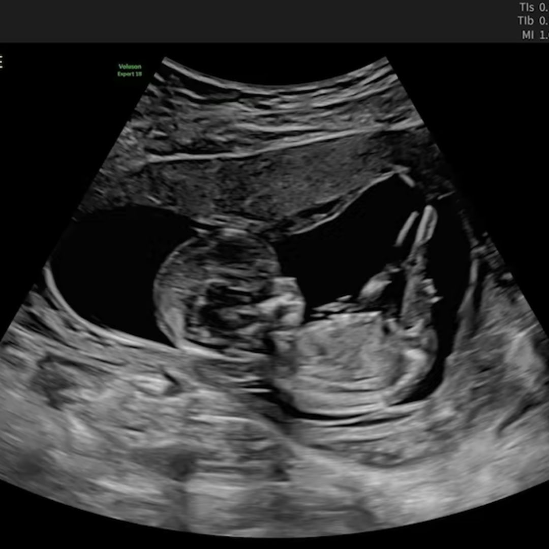 Photo shared by Mickie for their Babylist baby registry.