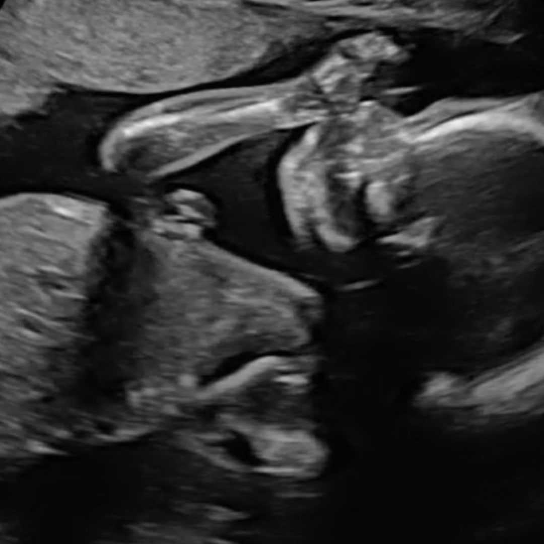 Photo shared by Shannon for their Babylist baby registry.