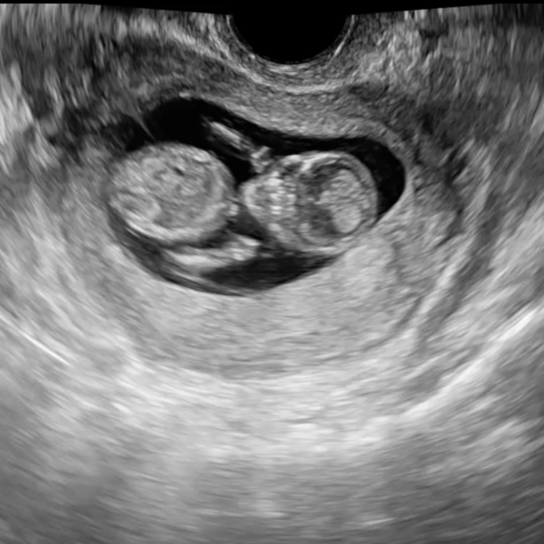 Photo shared by Jordan for their Babylist baby registry.