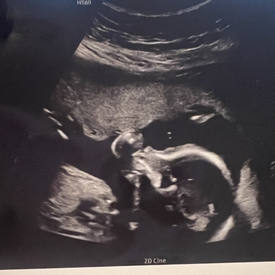 Photo shared by Jenny for their Babylist baby registry.