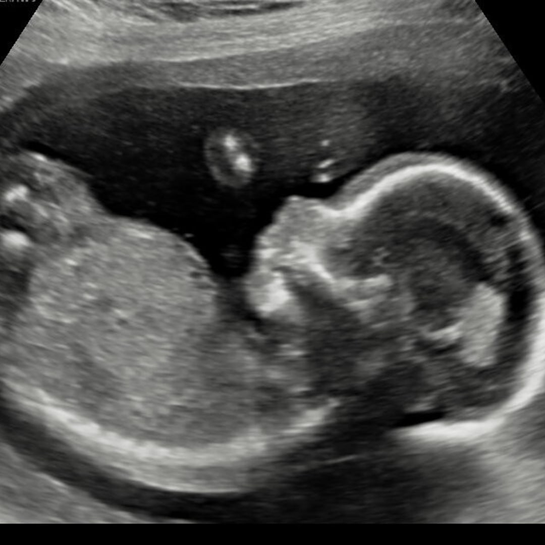 Photo shared by Meghan for their Babylist baby registry.