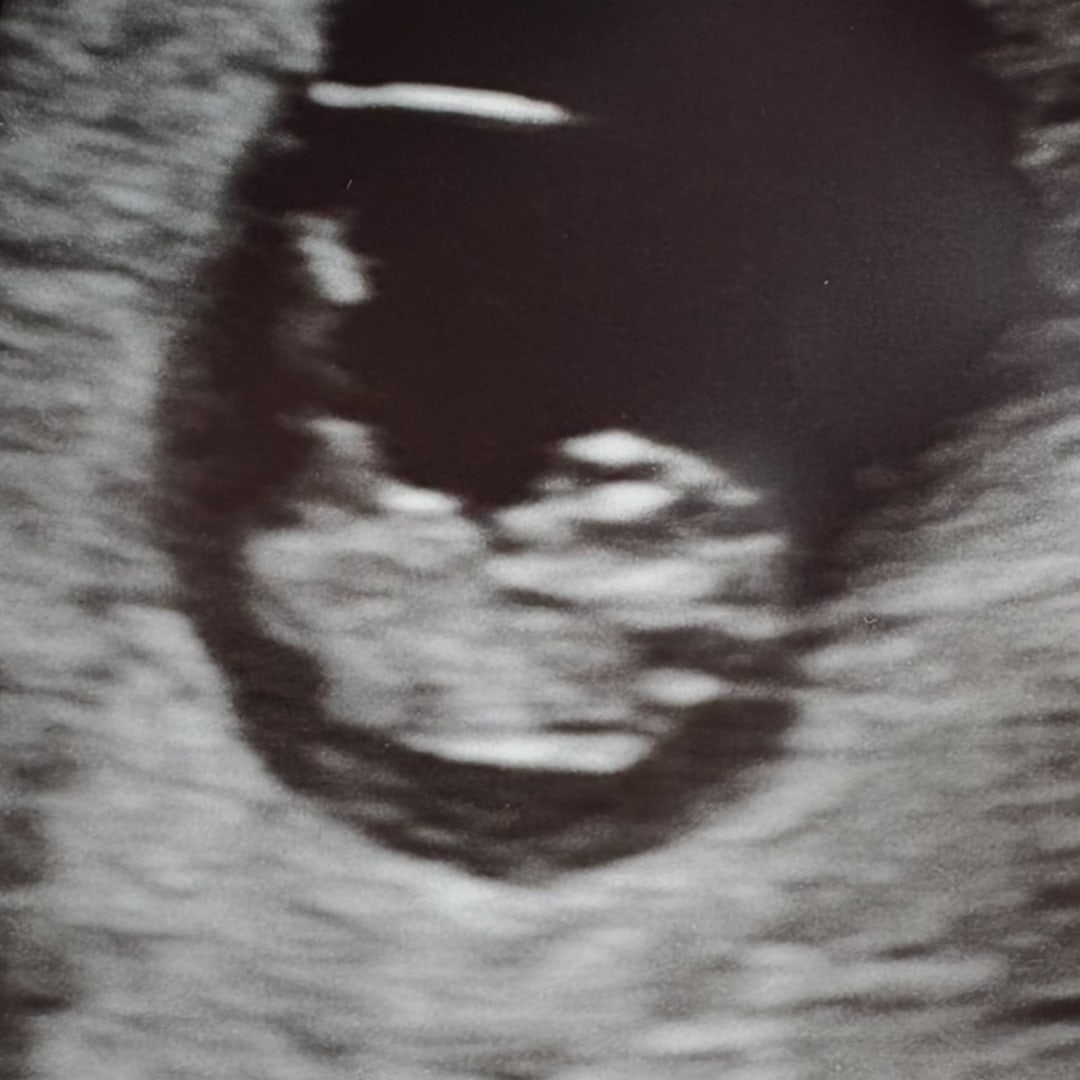 Photo shared by Kylie for their Babylist baby registry.