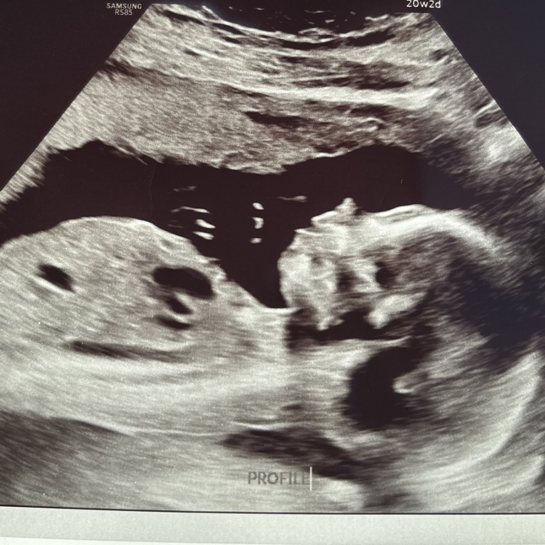 Photo shared by Mori for their Babylist baby registry.