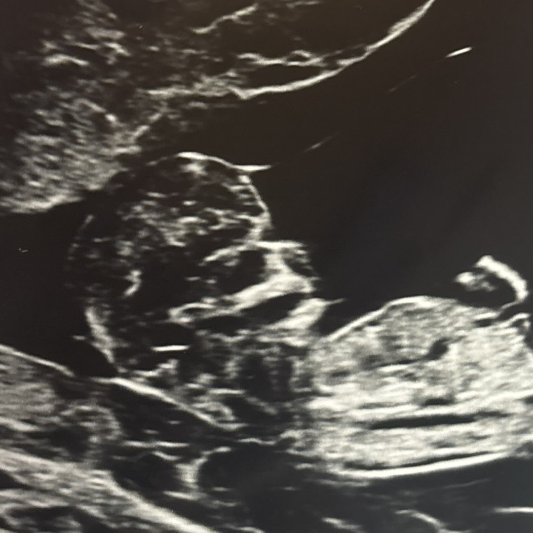 Photo shared by Alexzandra for their Babylist baby registry.