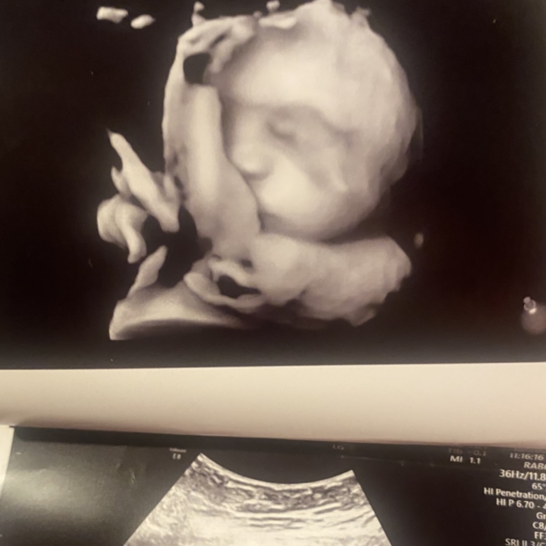 Photo shared by Amani for their Babylist baby registry.