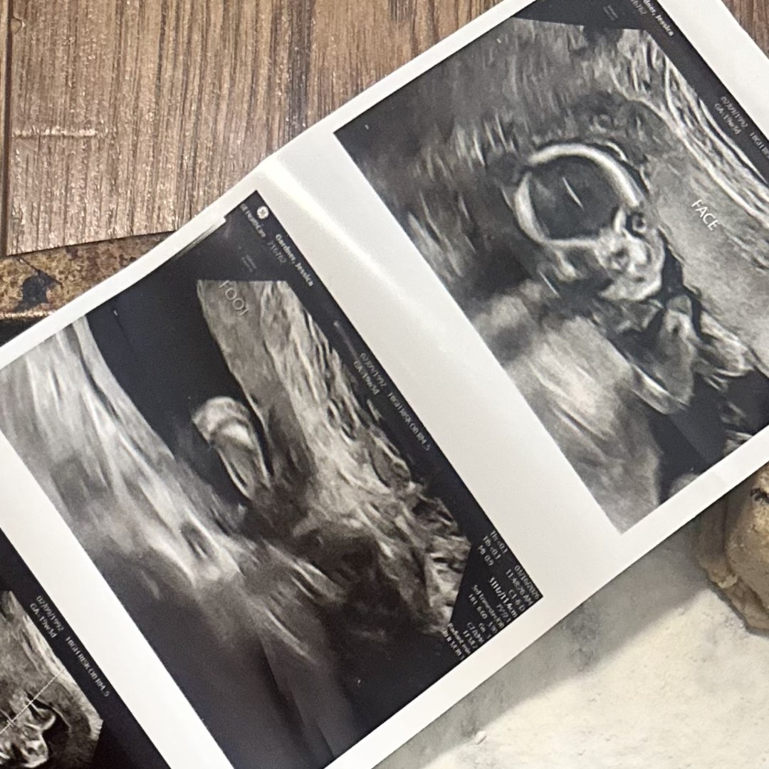 Photo shared by Jessica for their Babylist baby registry.