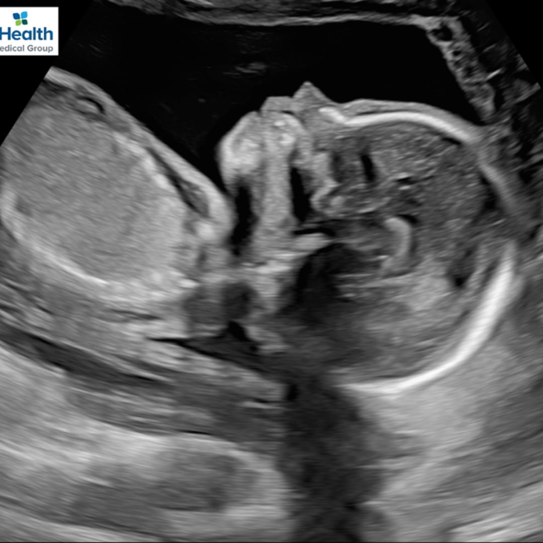 Photo shared by Mariana for their Babylist baby registry.