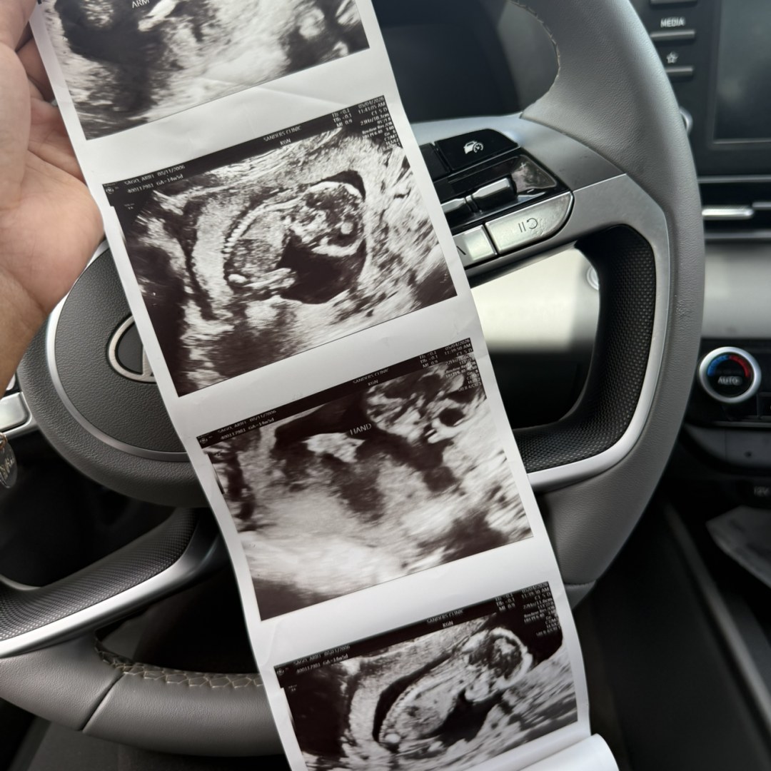 Photo shared by Ariel for their Babylist baby registry.