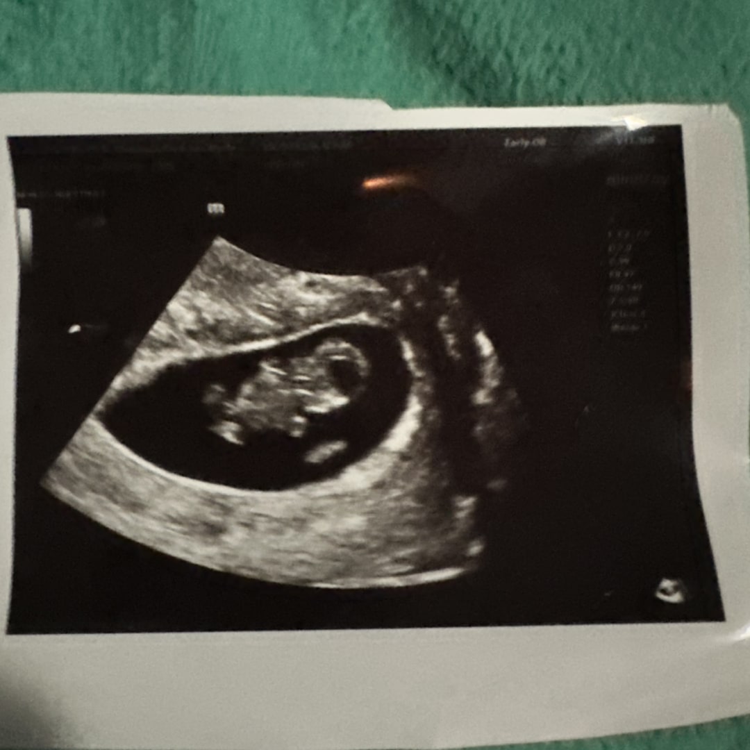 Photo shared by Janae for their Babylist baby registry.