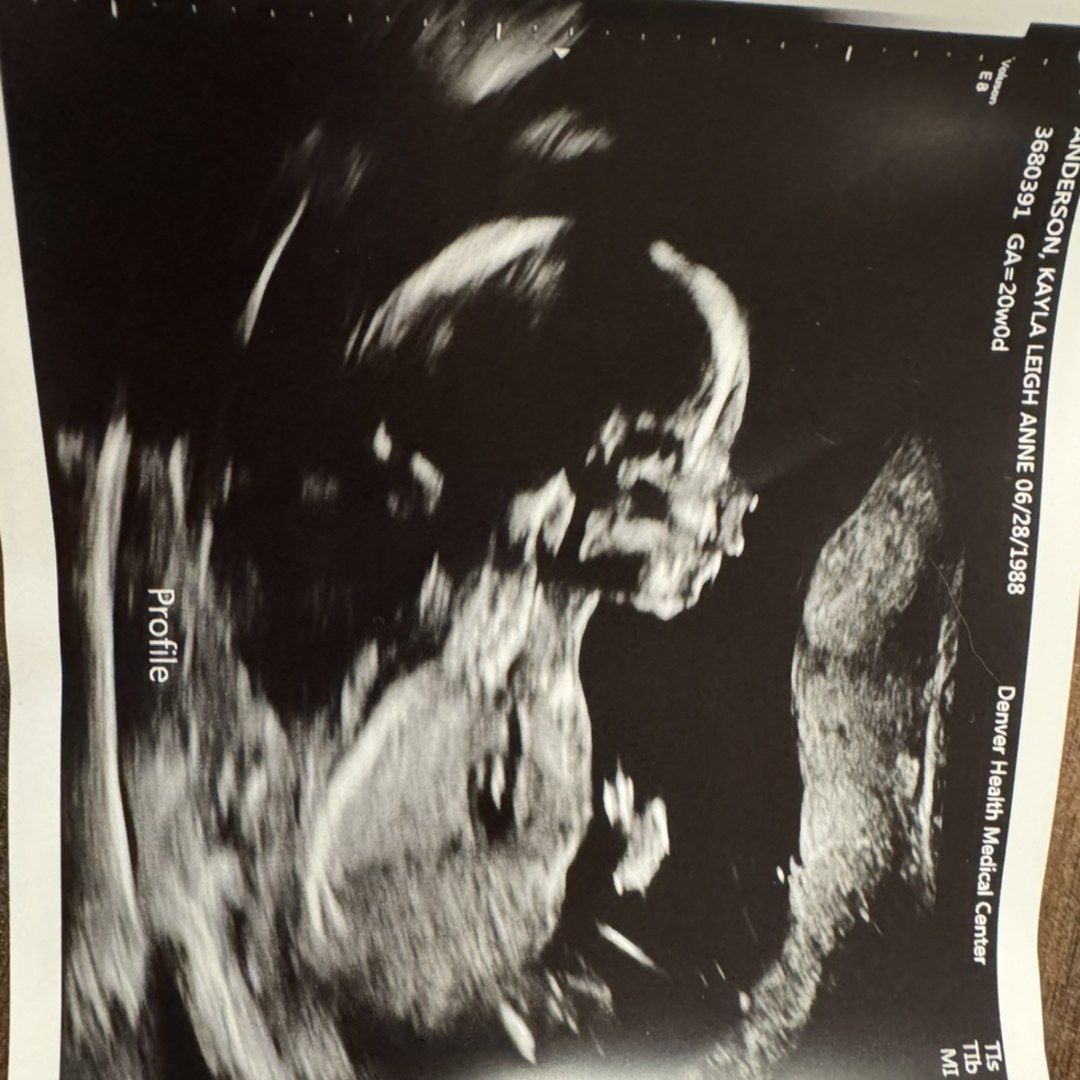 Photo shared by Zack for their Babylist baby registry.