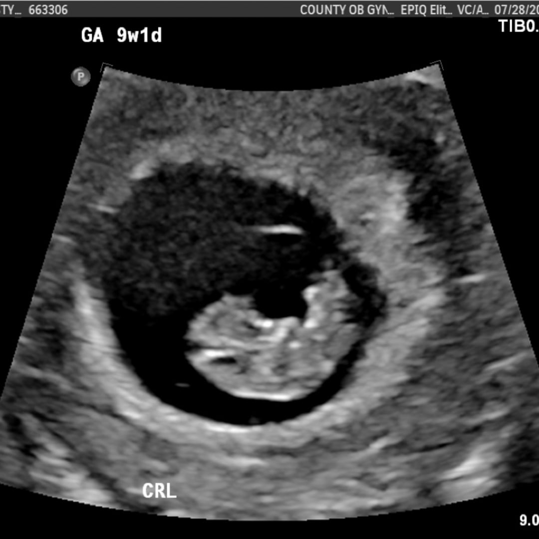 Photo shared by Kristy for their Babylist baby registry.