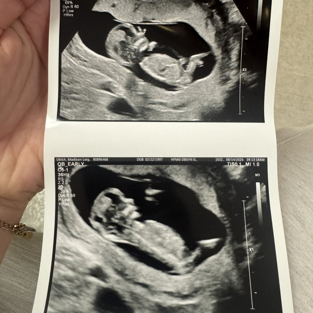 Photo shared by Madison for their Babylist baby registry.