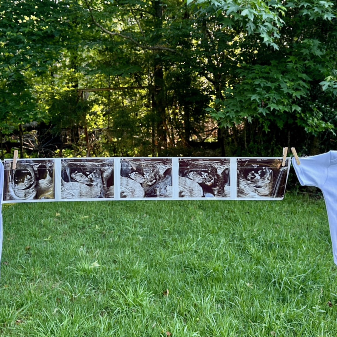 Photo shared by Cheyenne for their Babylist baby registry.
