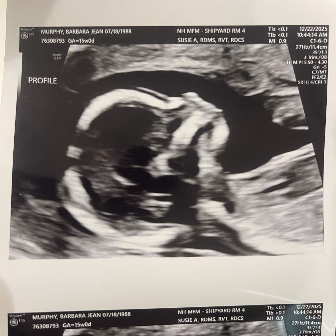 Photo shared by Barbara for their Babylist baby registry.