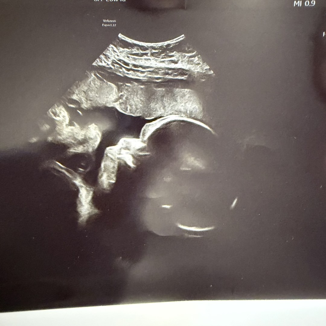 Photo shared by Gisela for their Babylist baby registry.