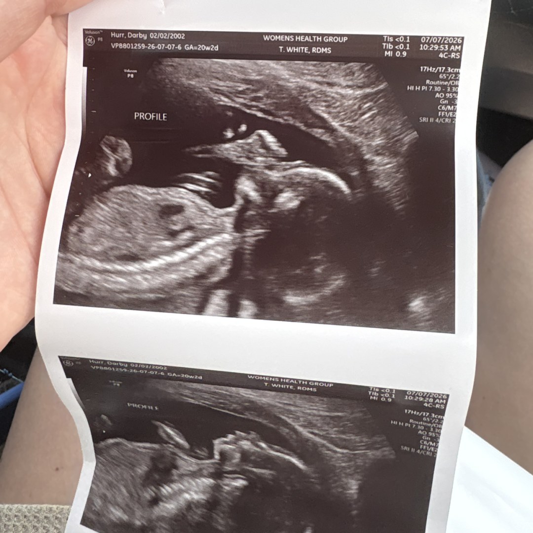 Photo shared by Darby for their Babylist baby registry.
