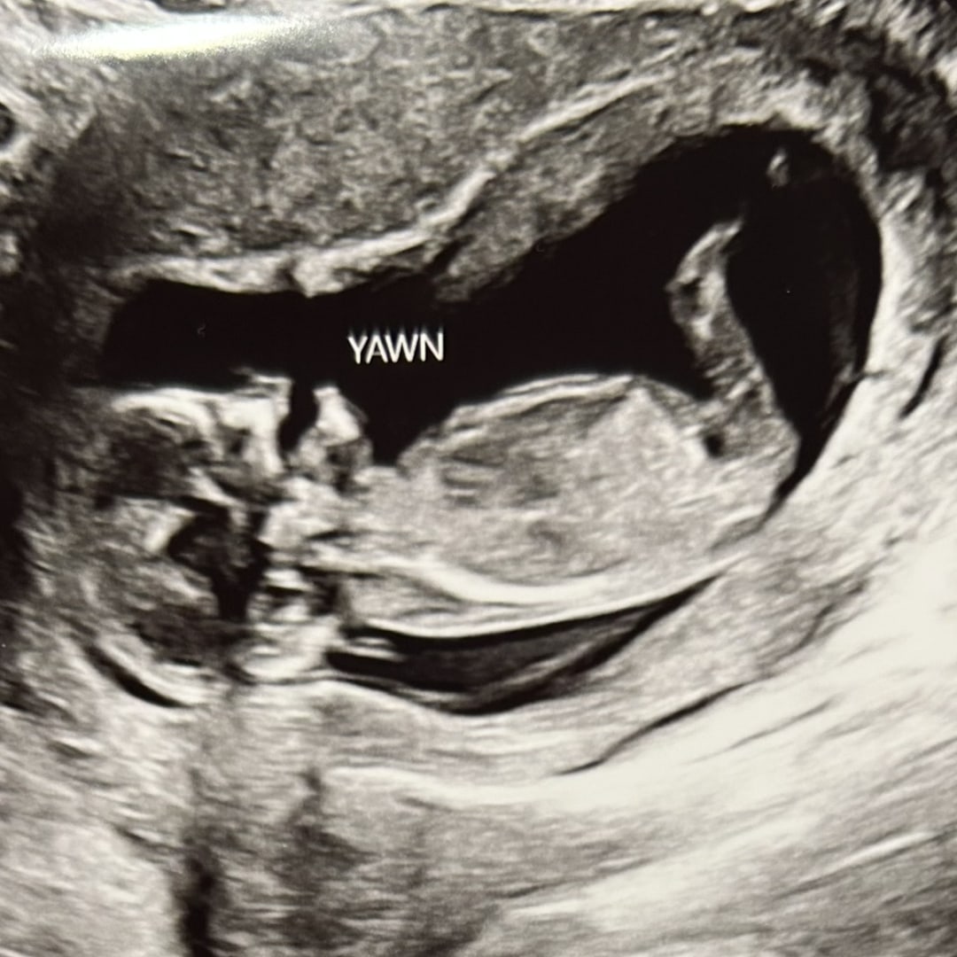 Photo shared by Katelin for their Babylist baby registry.