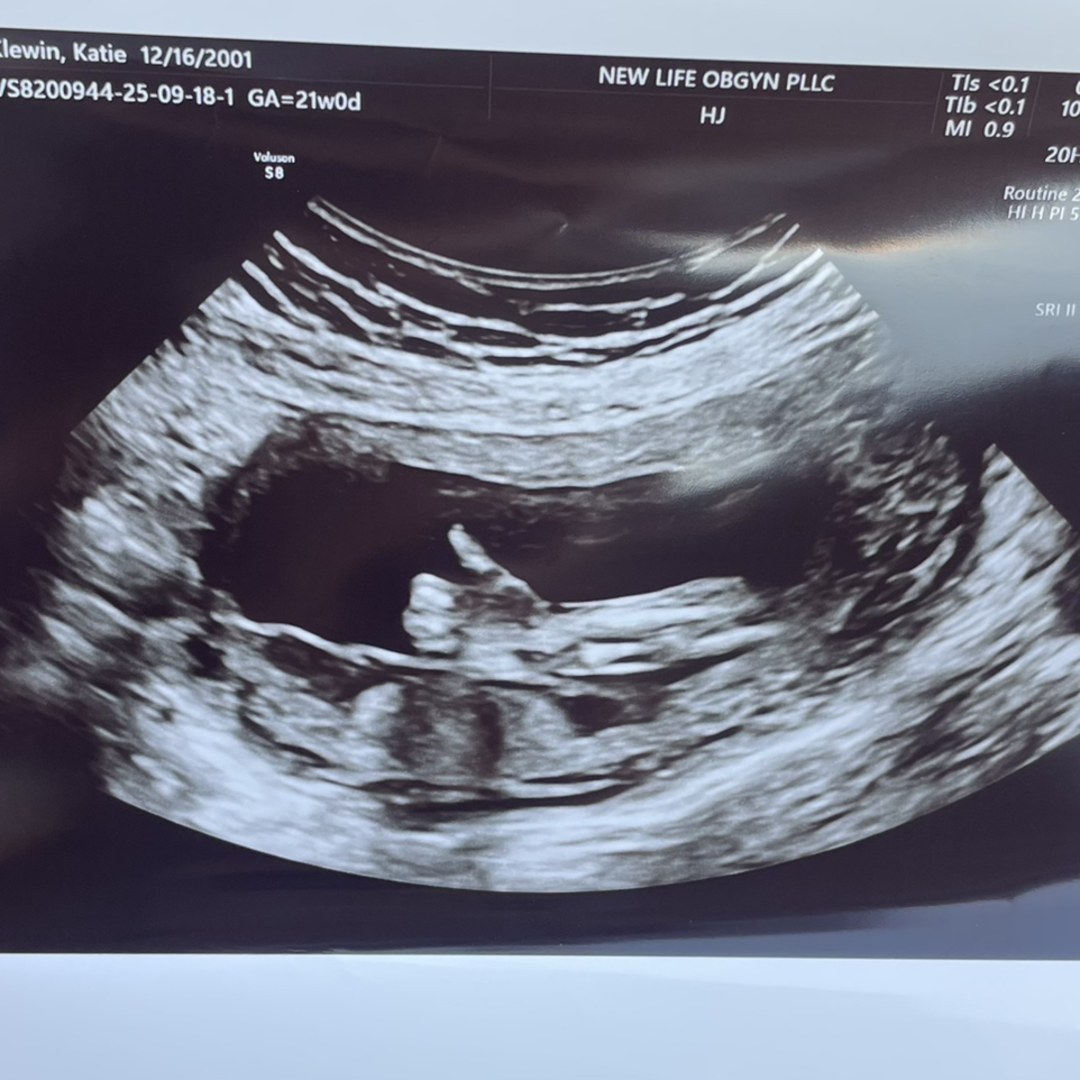 Photo shared by Katie for their Babylist baby registry.