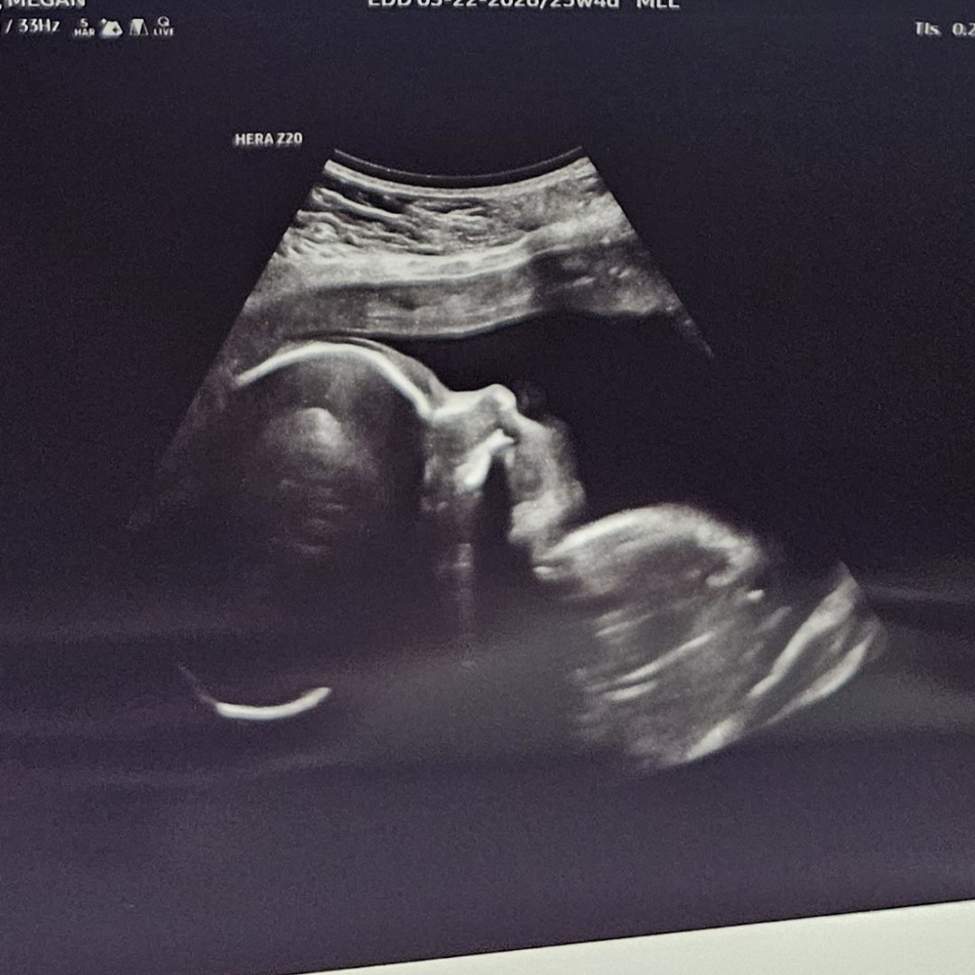 Photo shared by Megan for their Babylist baby registry.