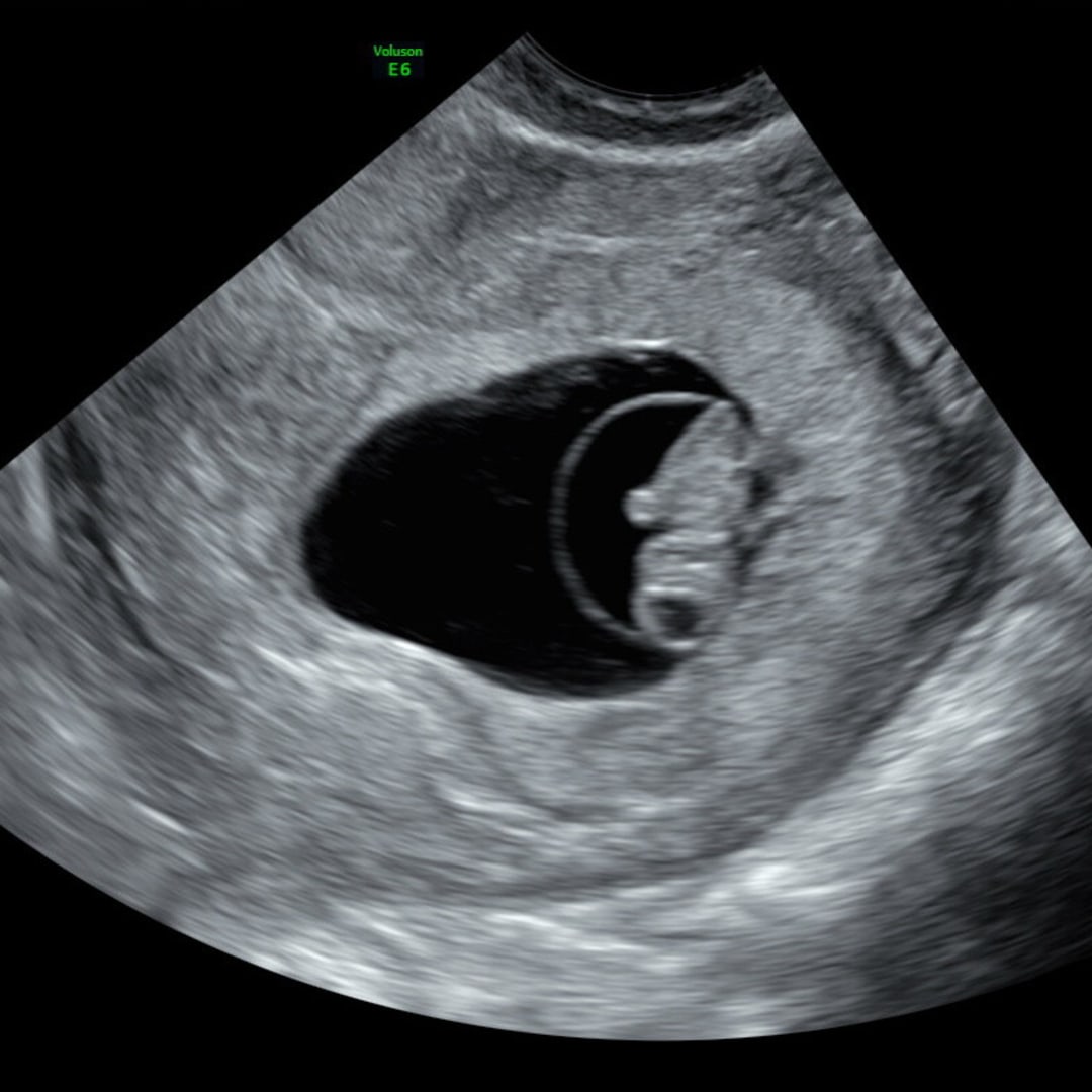 Photo shared by Molly for their Babylist baby registry.