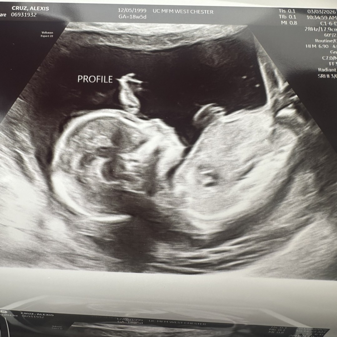 Photo shared by Lexi for their Babylist baby registry.