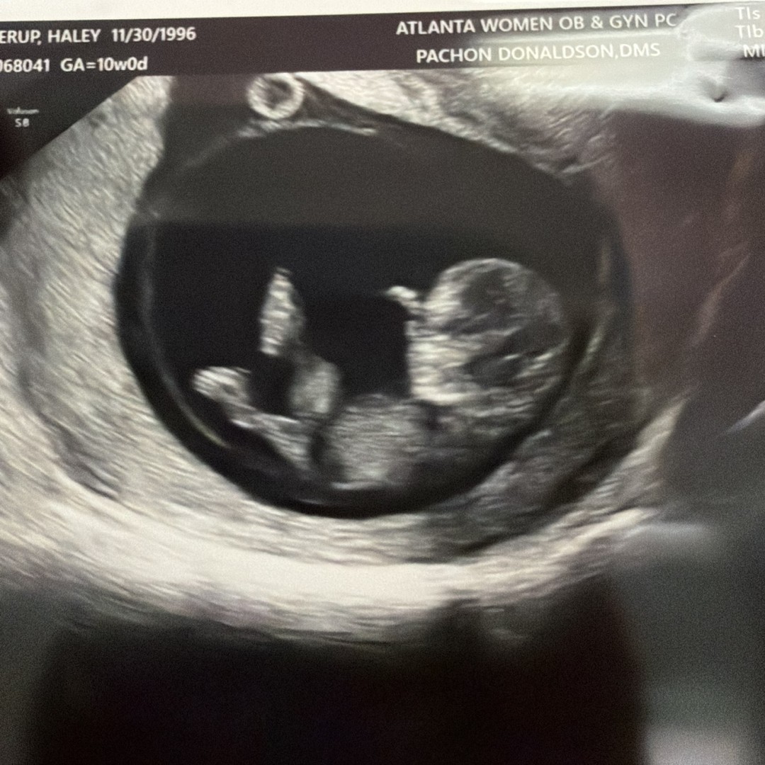 Photo shared by Haley for their Babylist baby registry.