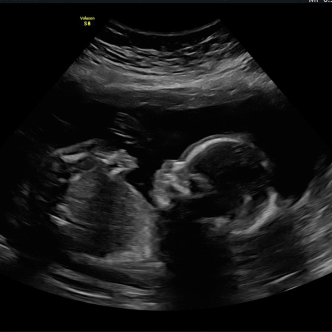 Photo shared by Bethany for their Babylist baby registry.