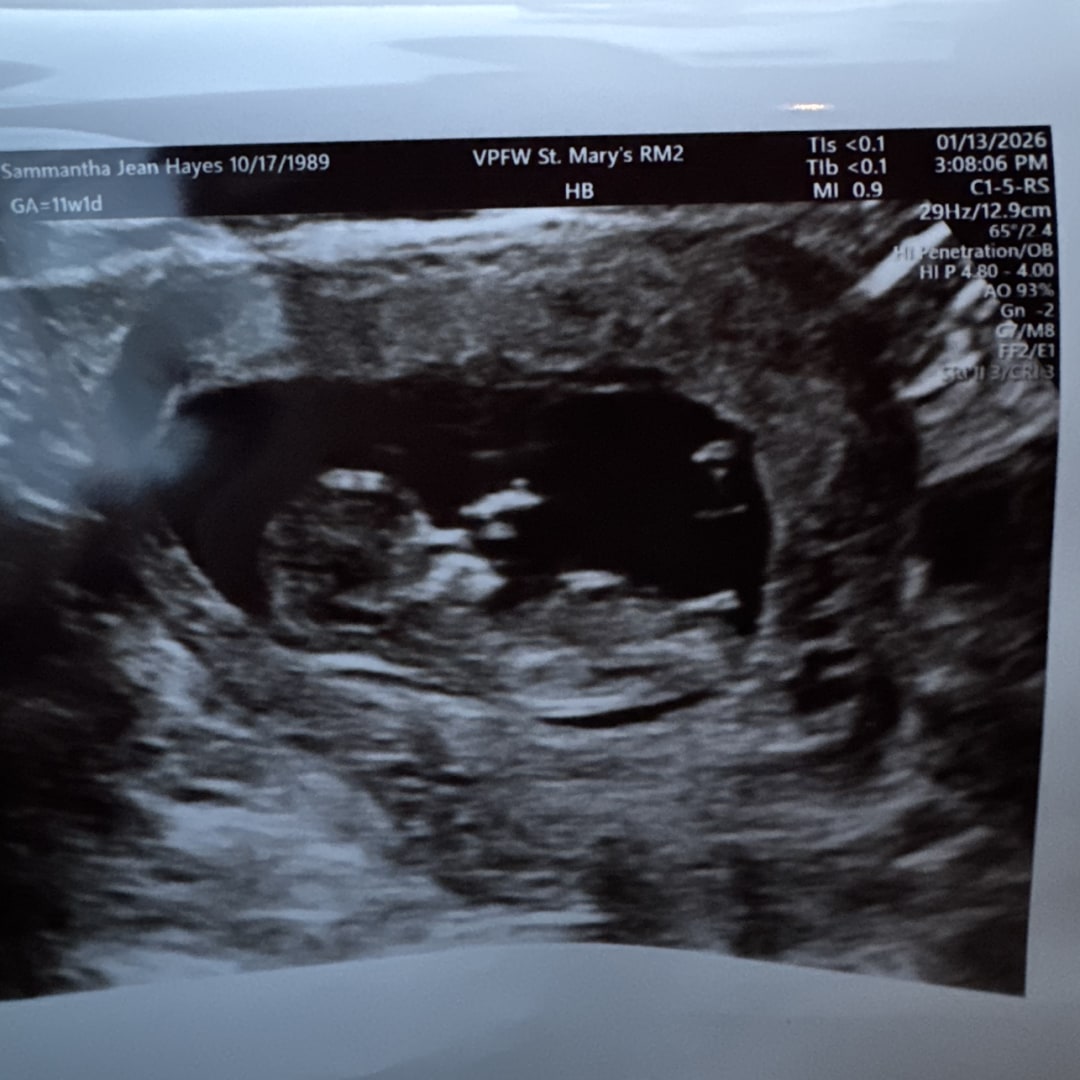 Photo shared by Sammie for their Babylist baby registry.