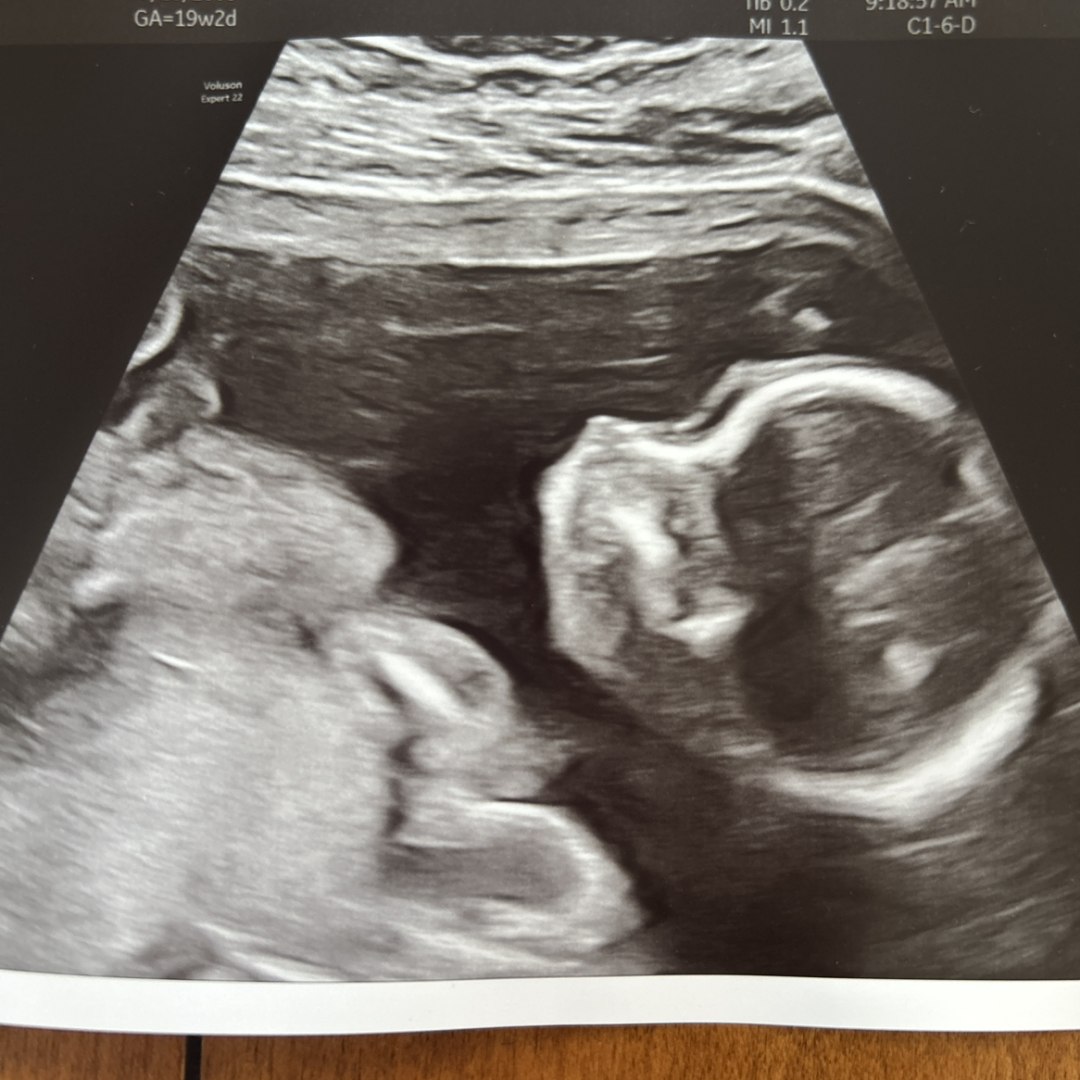 Photo shared by Genesis for their Babylist baby registry.