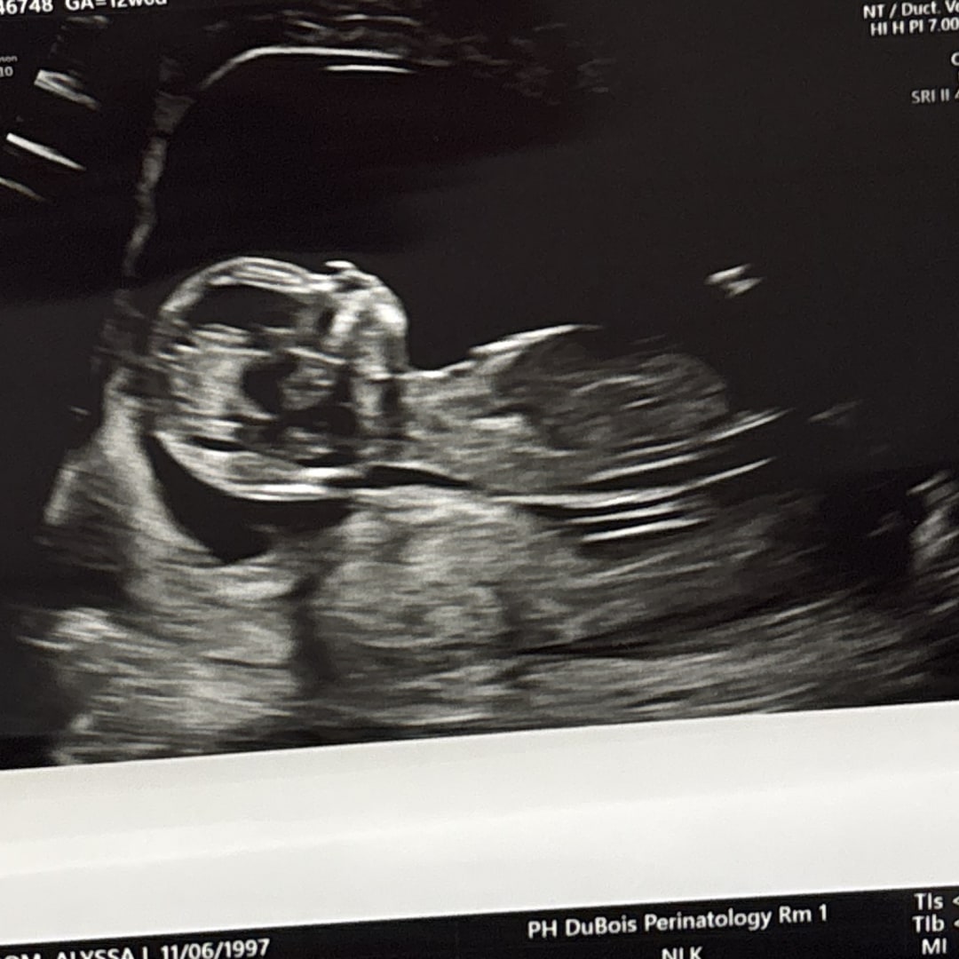 Photo shared by Alyssa for their Babylist baby registry.