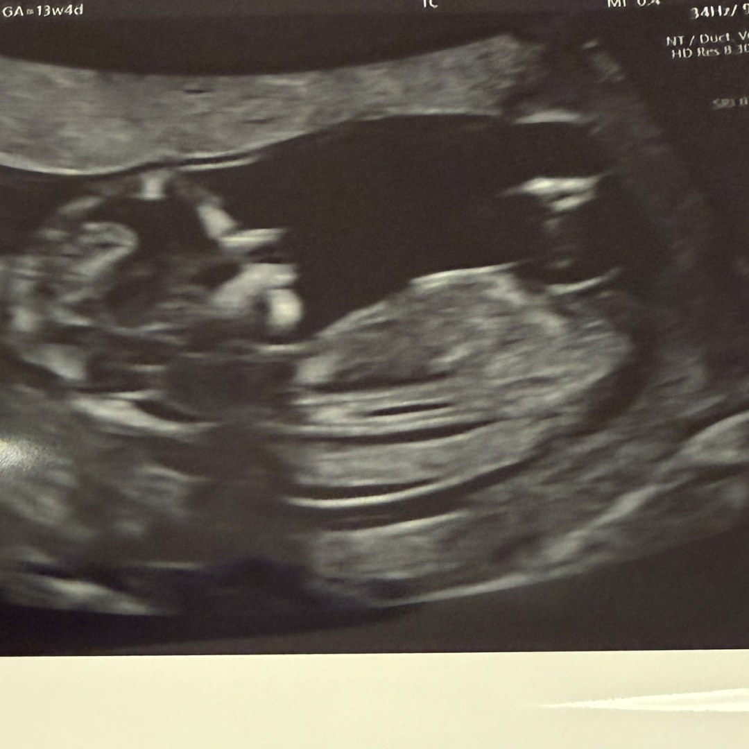 Photo shared by Amanda for their Babylist baby registry.