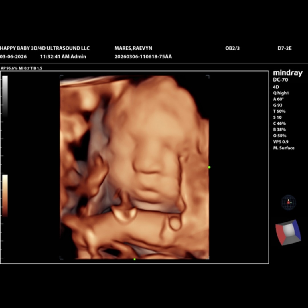 Photo shared by Raevyn for their Babylist baby registry.