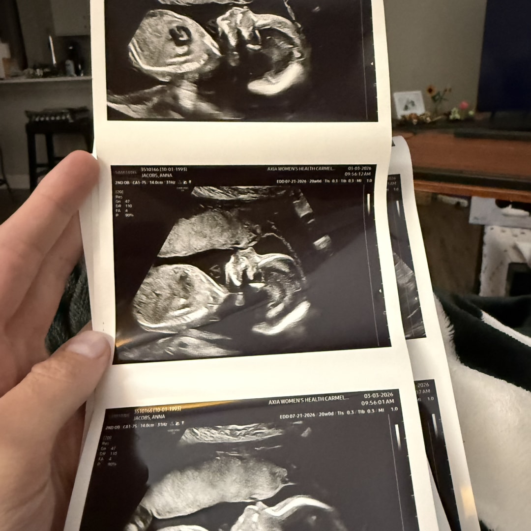 Photo shared by Anna for their Babylist baby registry.