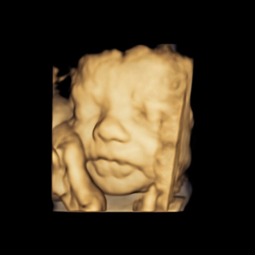 Photo shared by Kirk for their Babylist baby registry.