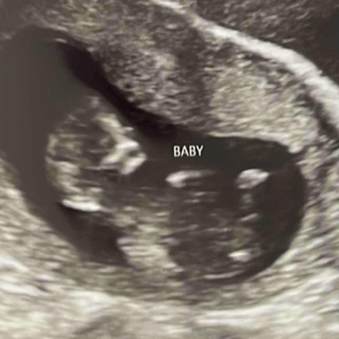 Photo shared by Destiny for their Babylist baby registry.