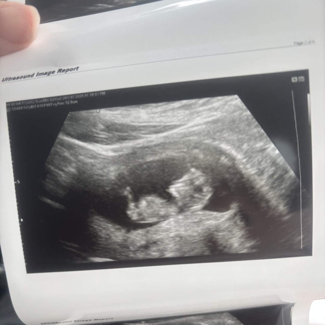 Photo shared by Brooke for their Babylist baby registry.