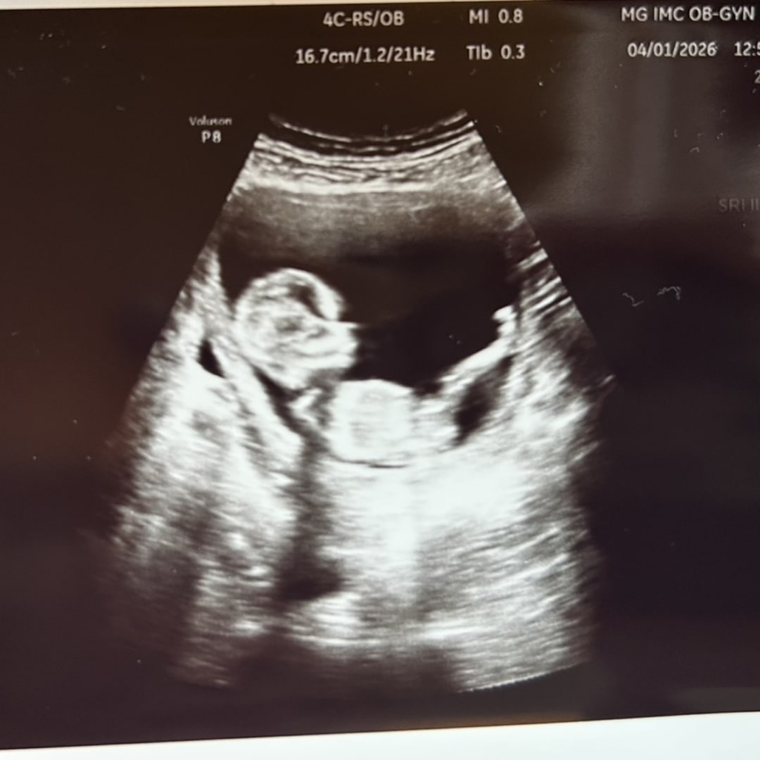 Photo shared by Carly for their Babylist baby registry.