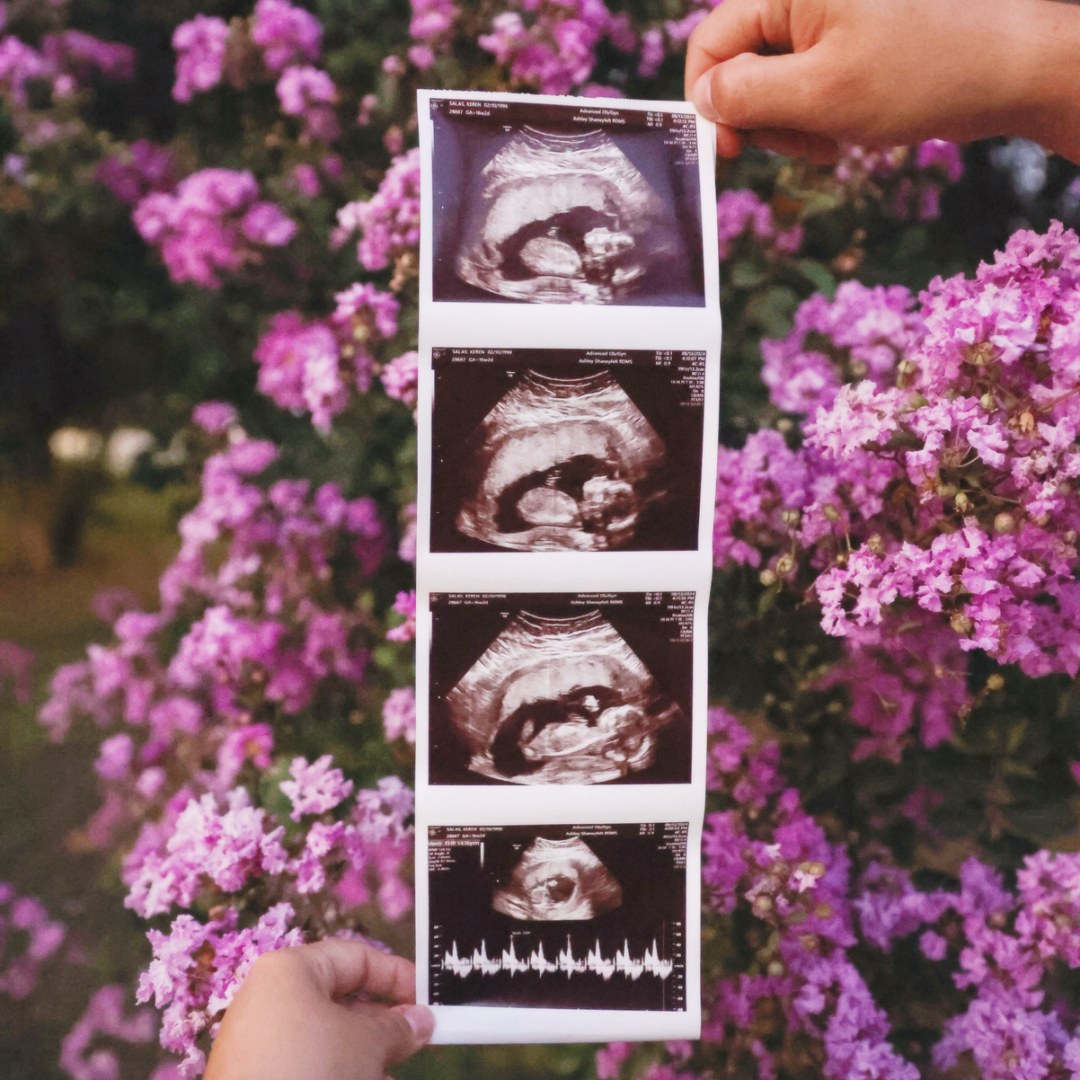 Photo shared by Keren for their Babylist baby registry.