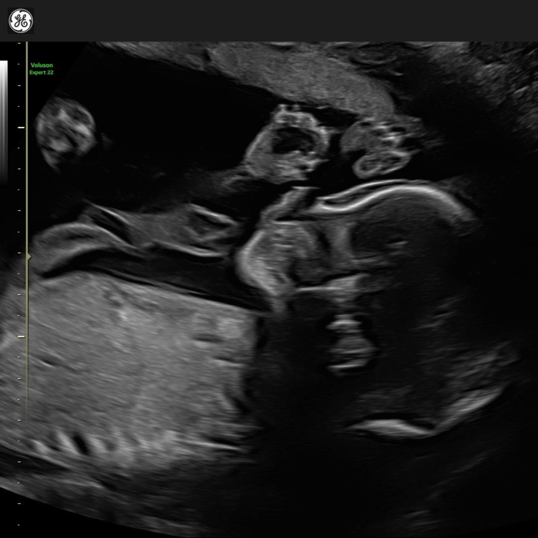 Photo shared by Bella for their Babylist baby registry.