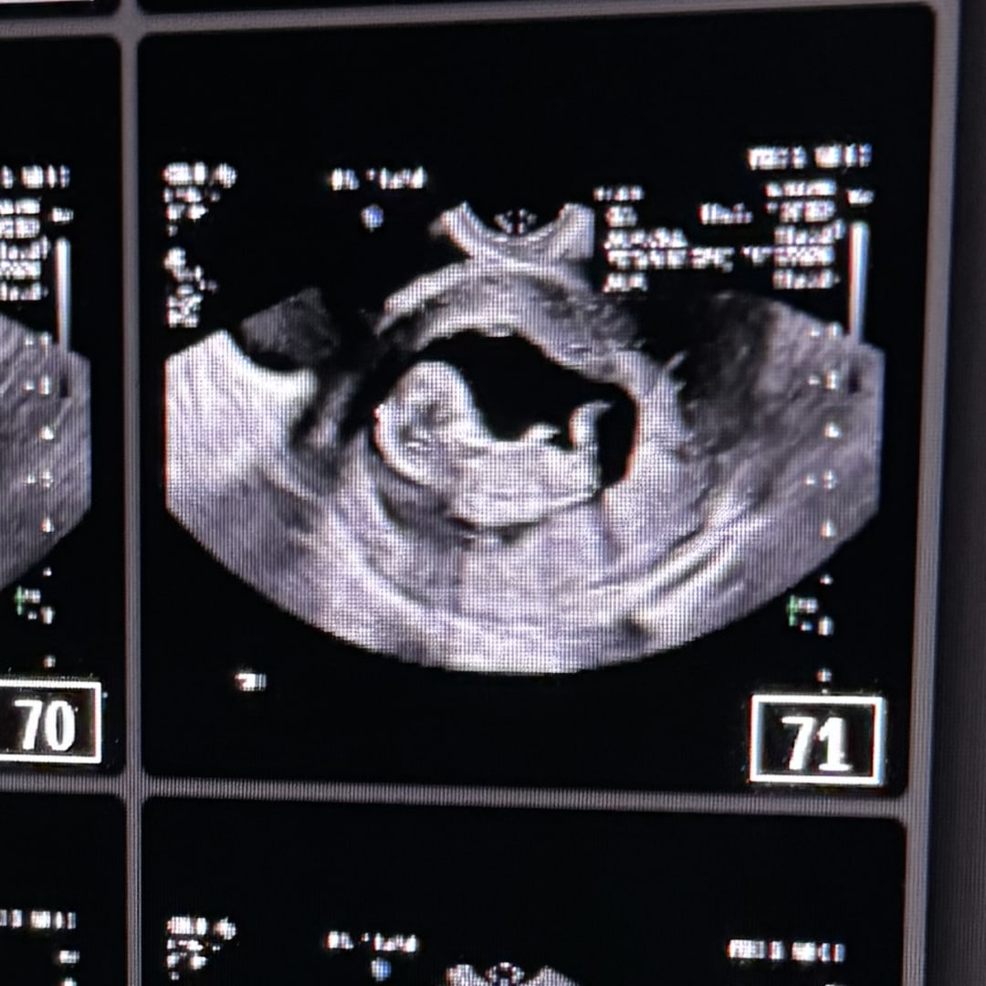 Photo shared by AJahnay for their Babylist baby registry.